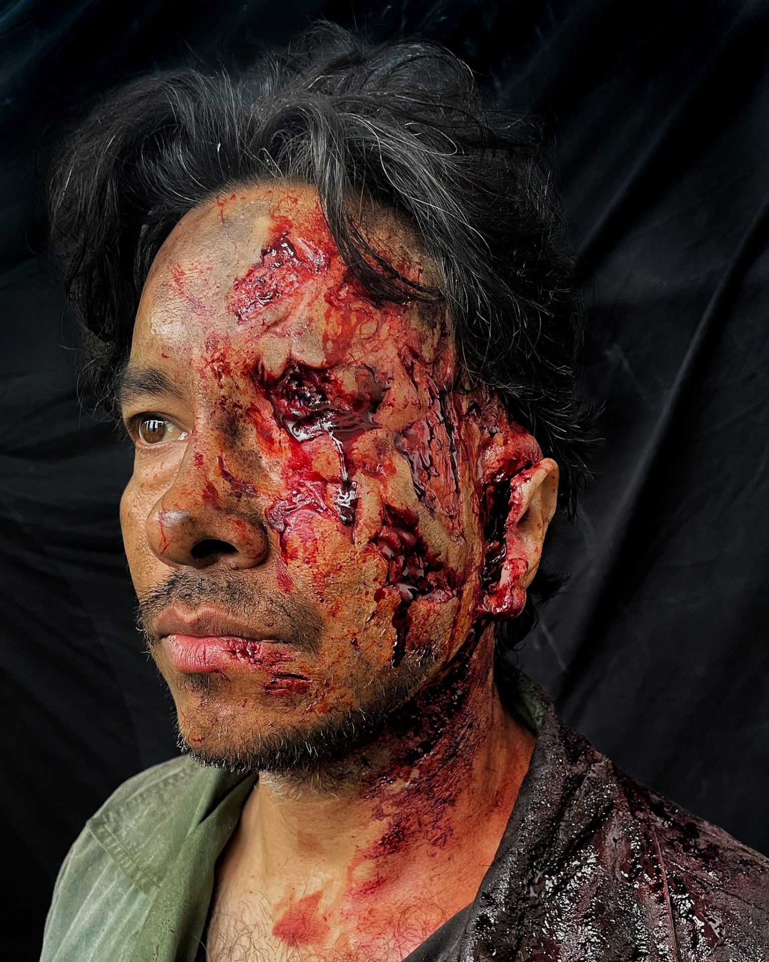 Palacio Trauma Facial