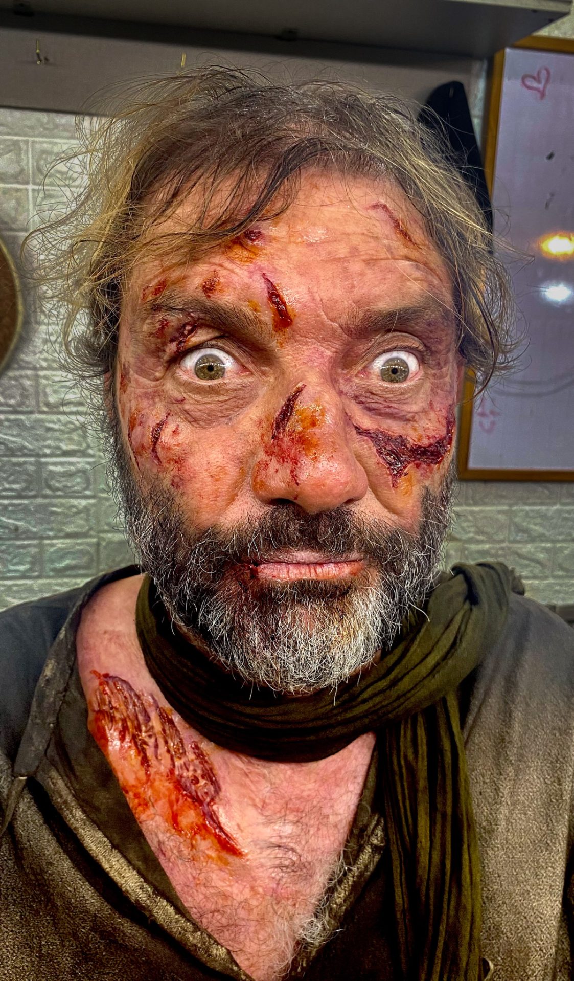 Los 39 Heridas en Set